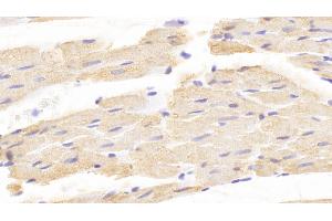 Detection of CRHBP in Rat Cardiac Muscle Tissue using Polyclonal Antibody to Corticotropin Releasing Hormone Binding Protein (CRHBP) (CRHBP Antikörper  (AA 25-322))