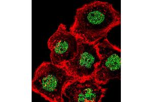 Fluorescent confocal image of A431 cell stained with HOMEZ Antibody (N-term). (HOMEZ Antikörper  (N-Term))