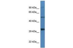 Image no. 1 for anti-Sarcoglycan, delta (35kDa Dystrophin-Associated Glycoprotein) (SGCD) (AA 37-86) antibody (ABIN6746239) (SGCD Antikörper  (AA 37-86))