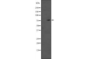 Western blot analysis of TAB2 expression in HEK293 cells ,The lane on the left is treated with the antigen-specific peptide. (TAB2 Antikörper  (Internal Region))