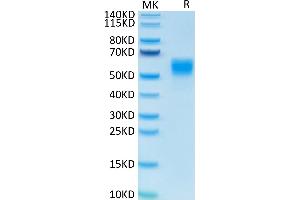 Human IL-13 on Tris-Bis PAGE under reduced condition. (IL-13 Protein (AA 21-132) (Fc Tag))