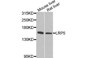 Western blot analysis of extracts of various cell lines, using LRP5 antibody (ABIN5974915) at 1/1000 dilution. (LRP5 Antikörper)