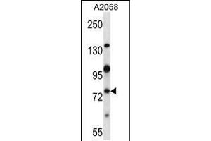 Western blot analysis in A2058 cell line lysates (35ug/lane). (NEK8 Antikörper  (C-Term))