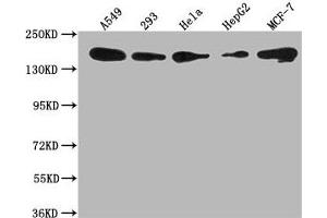 Western Blot Positive WB detected in: A549 whole cell lysate, 293 whole cell lysate, Hela whole cell lysate, HepG2 whole cell lysate, MCF-7 whole cell lysate All lanes: PLXNB2 antibody at 1:1000 Secondary Goat polyclonal to rabbit IgG at 1/50000 dilution Predicted band size: 206 kDa Observed band size: 206 kDa (Plexin B2 Antikörper  (AA 1458-1673))