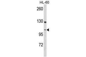Western blot analysis of Dynamin 3 Antibody (Center) in HL-60 cell line lysates (35ug/lane). (Dynamin 3 Antikörper  (Middle Region))