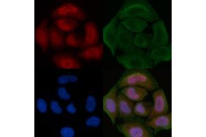 ABIN6260720 and ABIN6276822 staining Hela cells by IF/ICC.