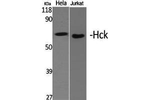 Western Blotting (WB) image for anti-Hemopoietic Cell Kinase (HCK) (Ser468) antibody (ABIN3184982) (HCK Antikörper  (Ser468))