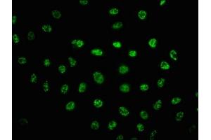 Immunofluorescence staining of Hela cells(treated with UV) with ABIN7127732 at 1:100,counter-stained with DAPI. (Rekombinanter PRKDC Antikörper  (pSer2056))