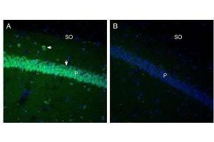 Expression of GPR91 in mouse hippocampus. (SUCNR1 Antikörper  (3rd Extracellular Loop))