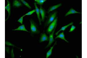 Immunofluorescence staining of Hela cells with ABIN7156276 at 1:66, counter-stained with DAPI. (Pyrophosphatase (Inorganic) 1 (PPA1) (AA 59-173) Antikörper)