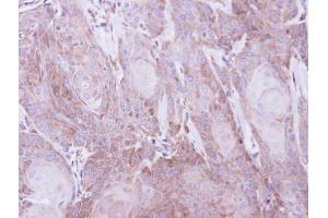 IHC-P Image Immunohistochemical analysis of paraffin-embedded Cal27 xenograft, using SEC61A1, antibody at 1:500 dilution. (SEC61A1 Antikörper  (C-Term))