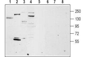 Western blot analysis of rat lung (lanes 1 and 5), rat heart membrane (lanes 2 and 6), mouse brain membrane (lanes 3 and 7) and ms1 mouse pancreas cells lysate (lanes 4 and 8): - 1-4. (TRPM4 Antikörper  (Intracellular, N-Term))