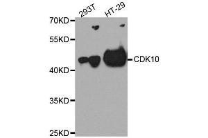 Western blot analysis of extracts of various cell lines, using CDK10 antibody. (CDK10 Antikörper  (AA 1-283))