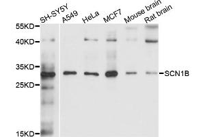 Western blot analysis of extracts of various cell lines, using SCN1B antibody (ABIN4905094) at 1:1000 dilution.