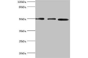 Western blot All lanes: Adenylosuccinate synthetase isozyme 2 antibody at 12 μg/mL Lane 1: Mouse skeletal muscle tissue Lane 2: HepG2 whole cell lysate Lane 3: K562 whole cell lysate Secondary Goat polyclonal to rabbit IgG at 1/10000 dilution Predicted band size: 50 kDa Observed band size: 50 kDa