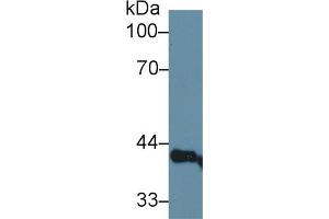 Western Blot; Sample: Rat Serum; Primary Ab: 1µg/ml Rabbit Anti-Rat LEDGF Antibody Second Ab: 0. (PSIP1 Antikörper  (AA 311-469))