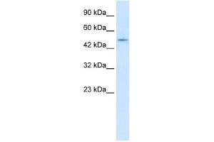 Western Blot showing ZNF651 antibody used at a concentration of 1-2 ug/ml to detect its target protein. (ZBTB47 Antikörper  (N-Term))