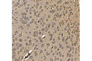 IHC analysis of SRP72 using anti-SRP72 antibody (ABIN7601648). (SRP72 Antikörper  (AA 40-460))