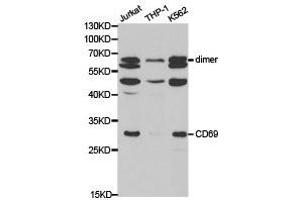 Western Blotting (WB) image for anti-CD69 (CD69) antibody (ABIN1871647) (CD69 Antikörper)