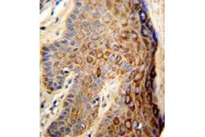 Immunohistochemistry (Paraffin-embedded Sections) (IHC (p)) image for anti-Family with Sequence Similarity 96, Member B (FAM96B) (C-Term), (N-Term) antibody (ABIN952260)