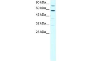 Western Blotting (WB) image for anti-Staphylococcal Nuclease Domain Containing Protein 1 (SND1) antibody (ABIN2460503)