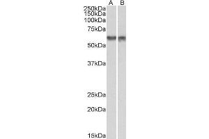 ABIN2564428 (1µg/ml) staining of nuclear NIH3T3 (A) and nuclear HeLa (B) lysates (35µg protein in RIPA buffer). (PDCD4 Antikörper  (Internal Region))