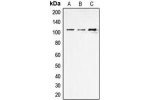 Western blot analysis of ERAP1 expression in THP1 (A), NIH3T3 (B), rat kidney (C) whole cell lysates.