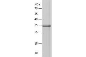 FGFR3 Protein (AA 23-320) (His tag)