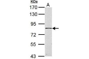 WB Image HSD17B4 antibody detects HSD17B4 protein by Western blot analysis. (HSD17B4 Antikörper)