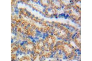 IHC-P analysis of Kidney tissue, with DAB staining. (GDNF Antikörper  (AA 78-211))