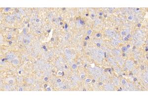 Immunohistochemistry (IHC) image for anti-Monoamine Oxidase A (MAOA) (AA 2-497) antibody (ABIN7440716)
