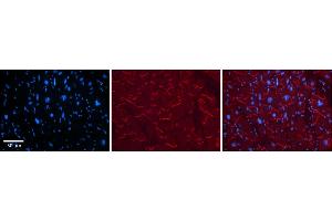 Rabbit Anti-KEAP1 Antibody    Formalin Fixed Paraffin Embedded Tissue: Human Adult heart  Observed Staining: Cytoplasmic (within intercalated disks) Primary Antibody Concentration: 1:600 Secondary Antibody: Donkey anti-Rabbit-Cy2/3 Secondary Antibody Concentration: 1:200 Magnification: 20X Exposure Time: 0. (KEAP1 Antikörper  (C-Term))