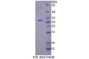 SDS-PAGE analysis of Mouse RFC5 Protein.