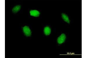 Immunofluorescence of purified MaxPab antibody to HIPK4 on HeLa cell. (HIPK4 Antikörper  (AA 1-616))