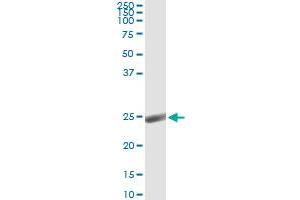 Western Blotting (WB) image for anti-Orosomucoid 1 (ORM1) (AA 18-201) antibody (ABIN562078)