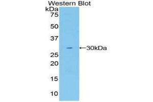 Western Blotting (WB) image for anti-Mindbomb E3 Ubiquitin Protein Ligase 1 (MIB1) (AA 769-1000) antibody (ABIN1859819) (MIB1 Antikörper  (AA 769-1000))