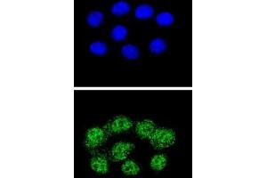 Confocal immunofluorescent analysis with Hela cells using MSH2 Antibody , followed by Alexa Fluor® 488-conjugated goat anti-rabbit lgG (green). (MSH2 Antikörper  (Middle Region))