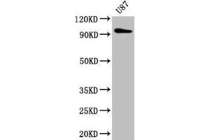 Western Blot Positive WB detected in: U87 whole cell lysate All lanes: TTLL6 antibody at 5 μg/mL Secondary Goat polyclonal to rabbit IgG at 1/50000 dilution Predicted band size: 97, 65 kDa Observed band size: 97 kDa (TTLL6 Antikörper  (AA 121-310))