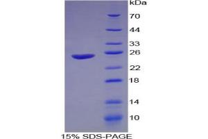 SDS-PAGE analysis of Guinea Pig Interferon alpha Protein. (IFNA Protein)