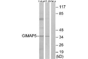 Immunohistochemistry analysis of paraffin-embedded human placenta tissue using GIMAP5 antibody. (GIMAP5 Antikörper  (Internal Region))