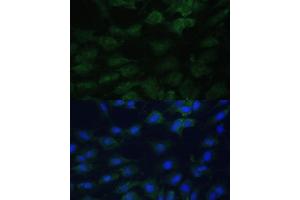 Immunofluorescence analysis of C6 cells using EIF1AX Polyclonal Antibody (ABIN6131999, ABIN6140017, ABIN6140018 and ABIN6221620) at dilution of 1:100 (40x lens). (EIF1AX Antikörper  (AA 10-144))