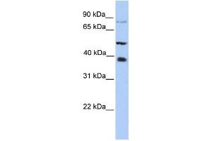 METTL2B antibody used at 1 ug/ml to detect target protein. (METTL2B Antikörper  (N-Term))