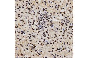 Immunohistochemistry of paraffin-embedded mouse liver fibrosis using PELP1 antibody (ABIN6292223) at dilution of 1:200 (40x lens). (PELP1 Antikörper)