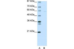 Western Blotting (WB) image for anti-SWI/SNF Related, Matrix Associated, Actin Dependent Regulator of Chromatin, Subfamily D, Member 3 (SMARCD3) antibody (ABIN2461185) (SMARCD3 Antikörper)
