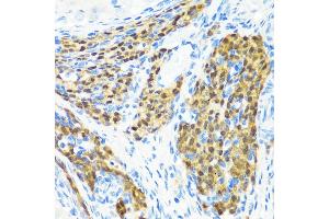 Immunohistochemistry (IHC) image for anti-Myeloid/lymphoid Or Mixed-Lineage Leukemia 5 (Trithorax Homolog) (MLL5) (AA 200-500) antibody (ABIN6142983)