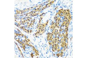 Immunohistochemistry of paraffin-embedded rat ovary using KMT2E antibody (ABIN6131786, ABIN6142983, ABIN6142984 and ABIN6221745) at dilution of 1:200 (40x lens). (MLL5/KMT2E Antikörper  (AA 200-500))