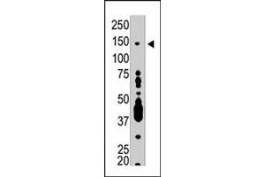 The USP7 polyclonal antibody  is used in Western blot to detect USP7 in T-47D cell lysate . (USP7 Antikörper  (C-Term))