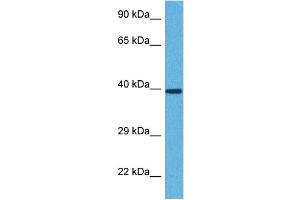 Host:  Rabbit  Target Name:  ST3GAL4  Sample Tissue:  Human 786-0 Whole Cell  Antibody Dilution:  1ug/ml (ST3GAL4 Antikörper  (Middle Region))