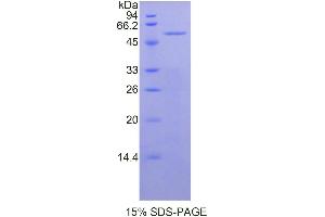 SDS-PAGE (SDS) image for Mesothelin (MSLN) (AA 400-615) protein (His tag,GST tag) (ABIN2123261) (Mesothelin Protein (MSLN) (AA 400-615) (His tag,GST tag))