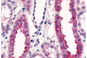 Immunohistochemistry (Formalin/PFA-fixed paraffin-embedded sections) of human kidney, renal tubules with VN1R1 polyclonal antibody . (VN1R1 Antikörper  (C-Term))
